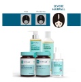 Female Hairfall Solution, Female Severe
