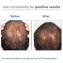 6 - HK Vitals Advanced Hairloss Kit by HealthKart,  3 Piece(s)/Pack  Combo