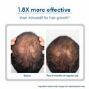 5 - HK Vitals Headful Growth+ Serum by HealthKart,  30 ml  All Hair Type