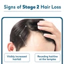 5 - HK Vitals Hair Fall Solution,  STAGE 2