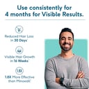 5 - HK Vitals Hair Fall Solution,  STAGE 3