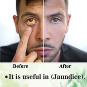 3 - Cipzer Jaundice Cure Syrup, 200 ml