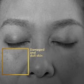 2 - VLCC Clinic ProRescue Bio Cream,  100 g  2X Peptide + 3X Ceramide