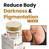 2 - myUpchar Ayurveda Brightening & Whitening Body Cream, 50 g for Dark Patches